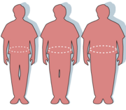 obesity health risk