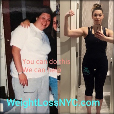 before-after weight loss photo